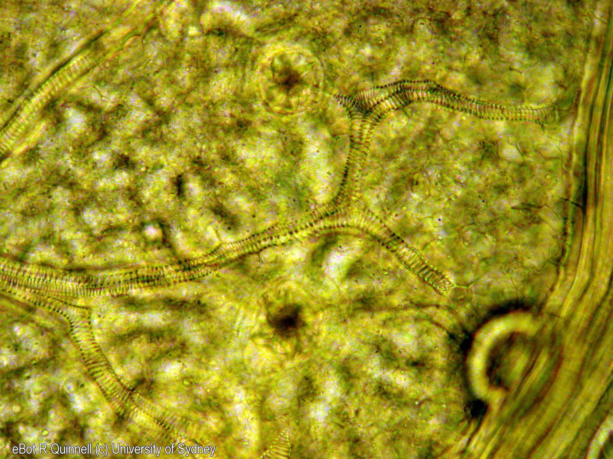 Paradermal view cleared Acalypha leaf