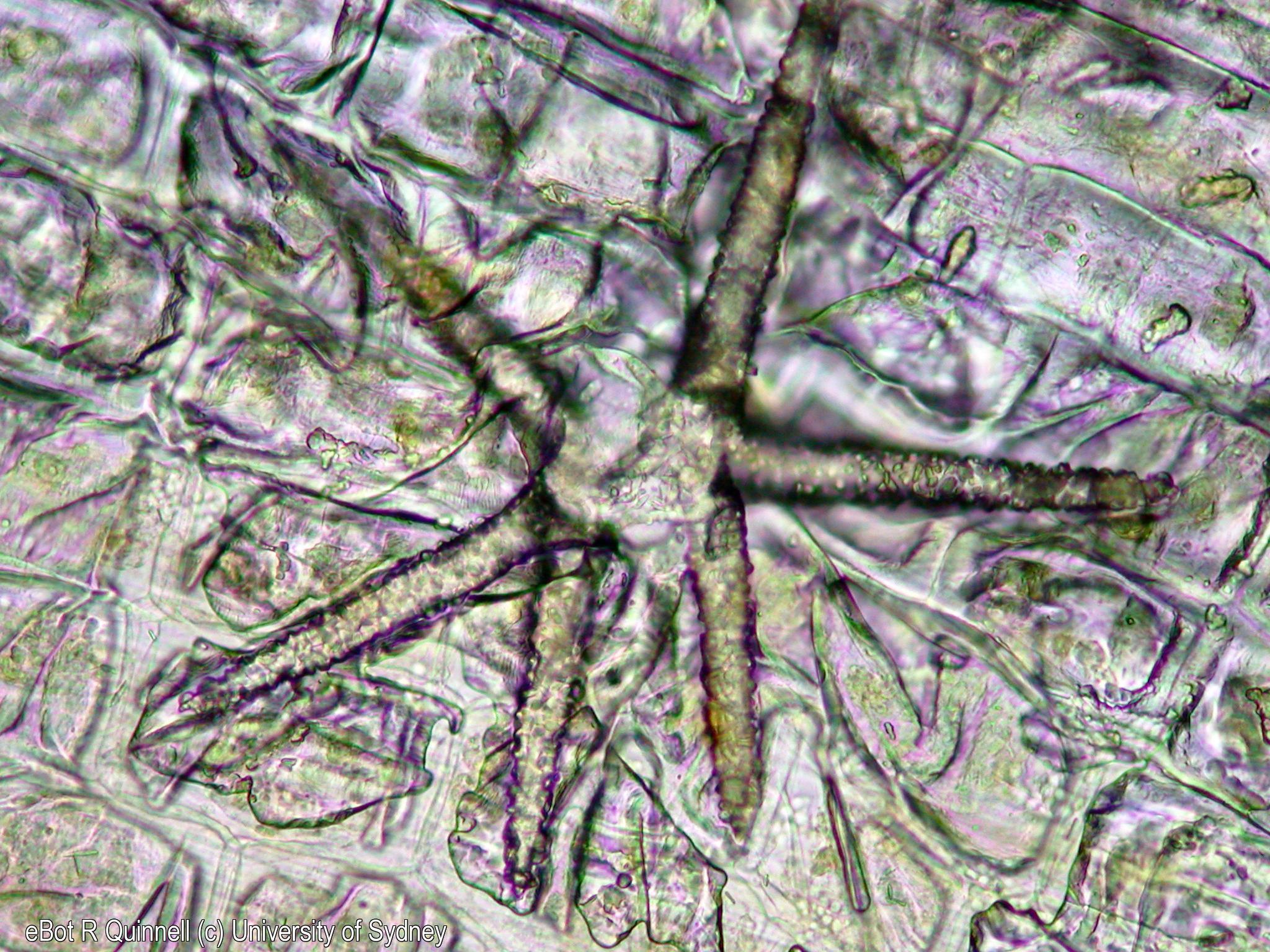 TS Nymphaea Stellate Sclerid University Of Sydney Library