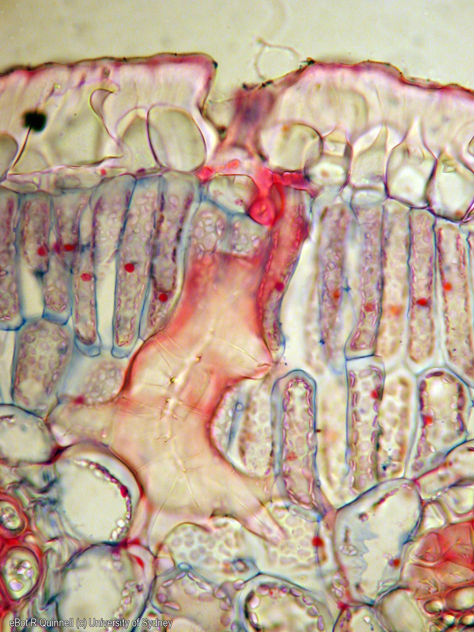 TS Hakea dactyloides leaf sclerid