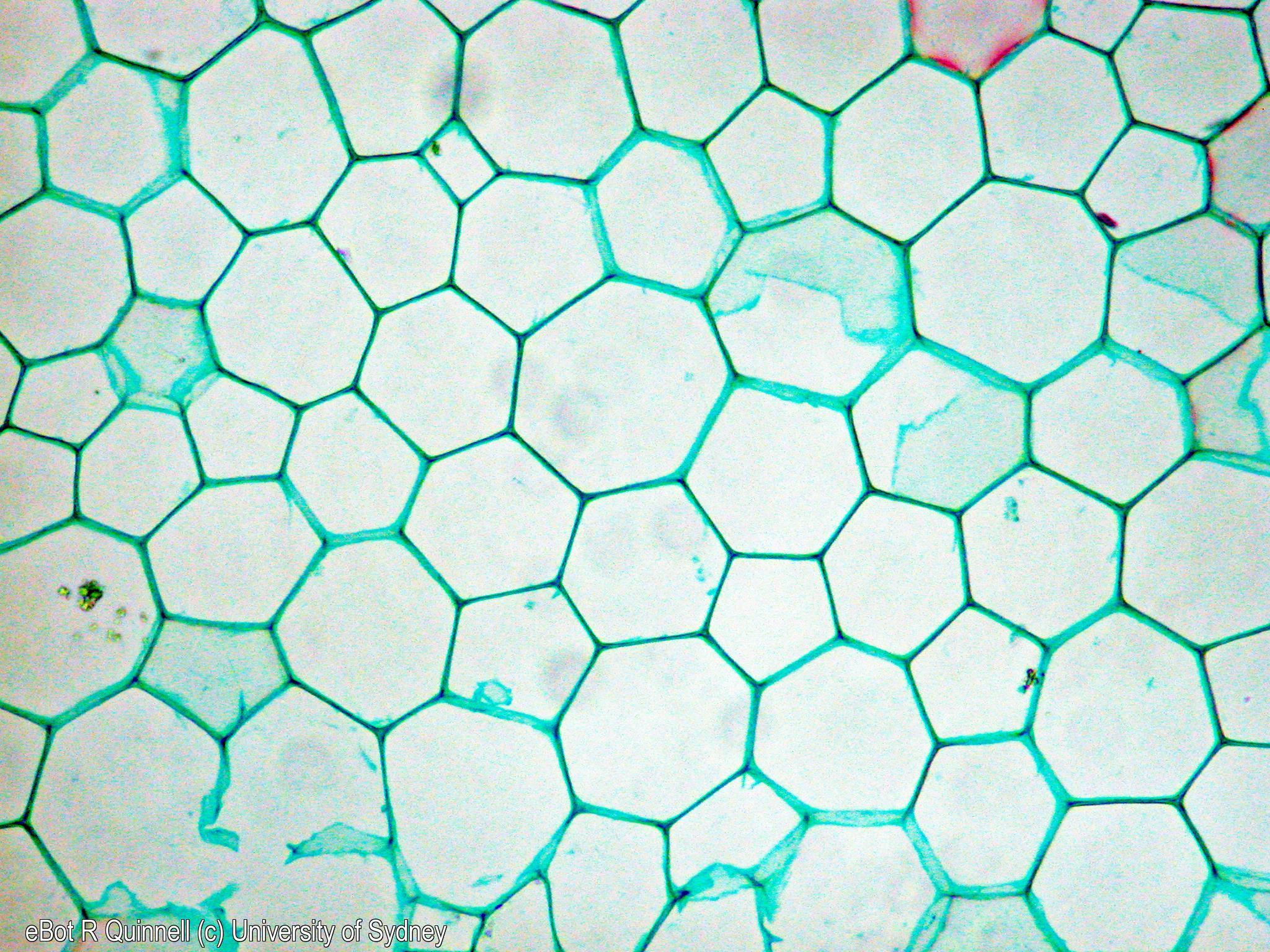 TS Helianthus stem pith parenchyma