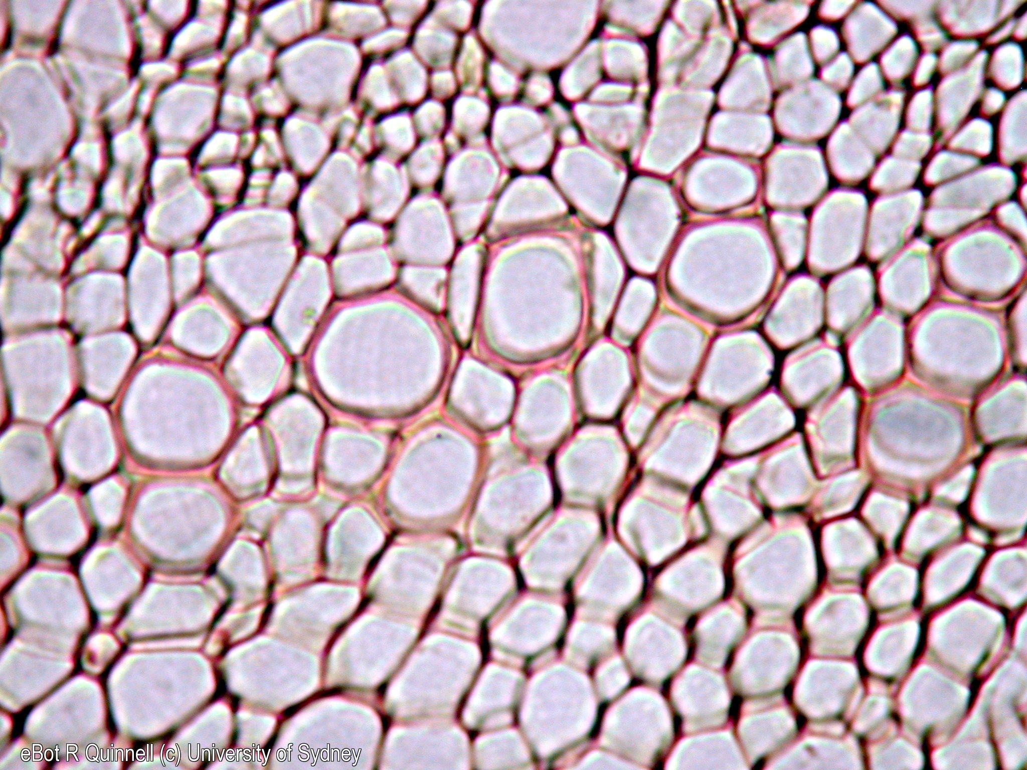 TS Dianthus cladode vascular tissue