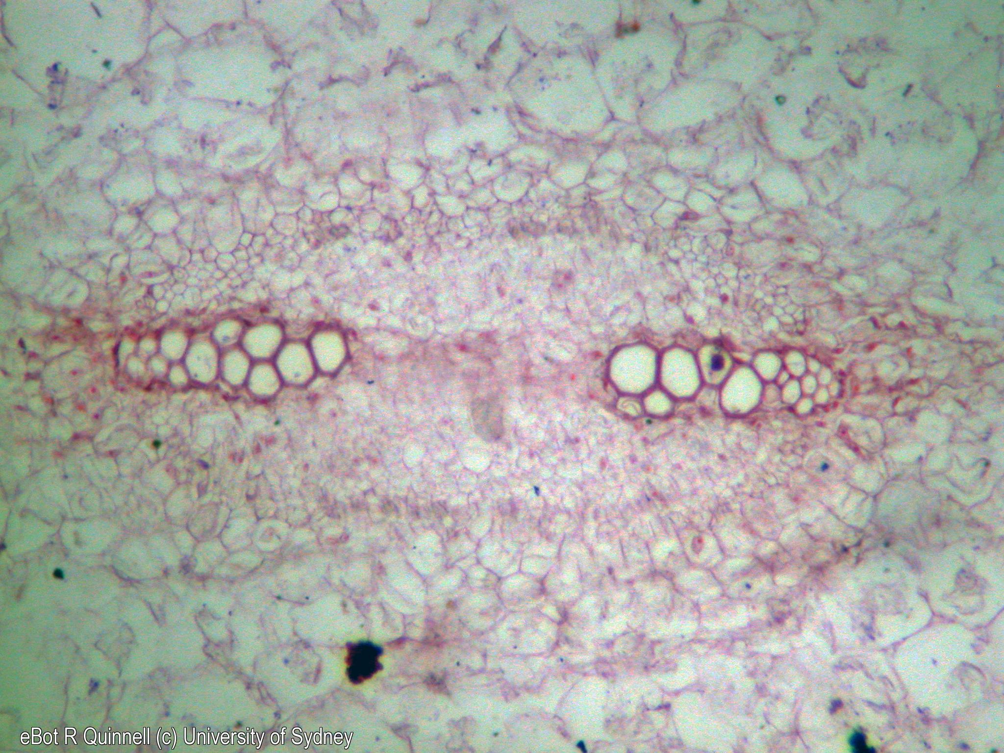 TS Lupinus root stele
