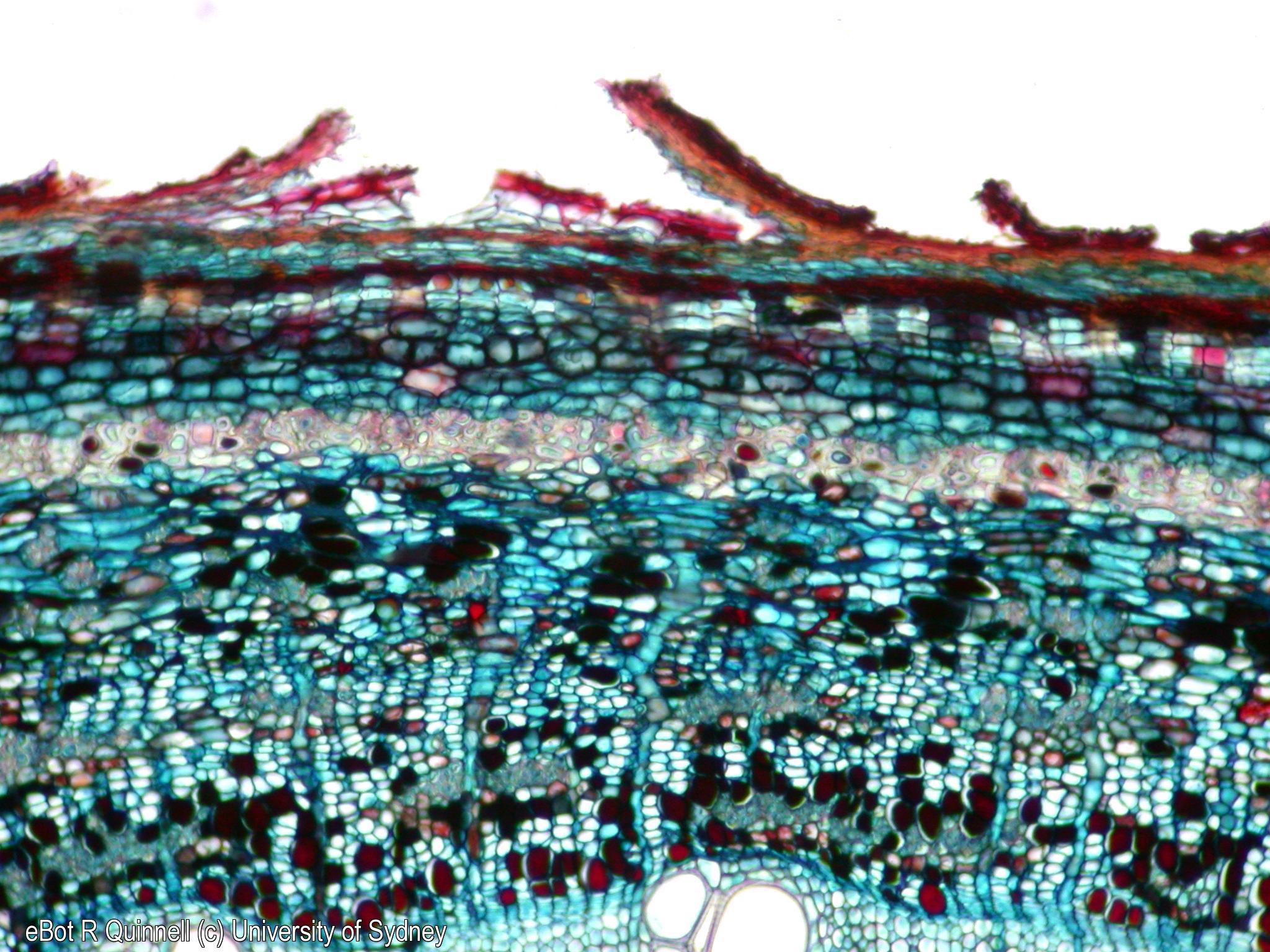 TS Acacia longifolia woody stem