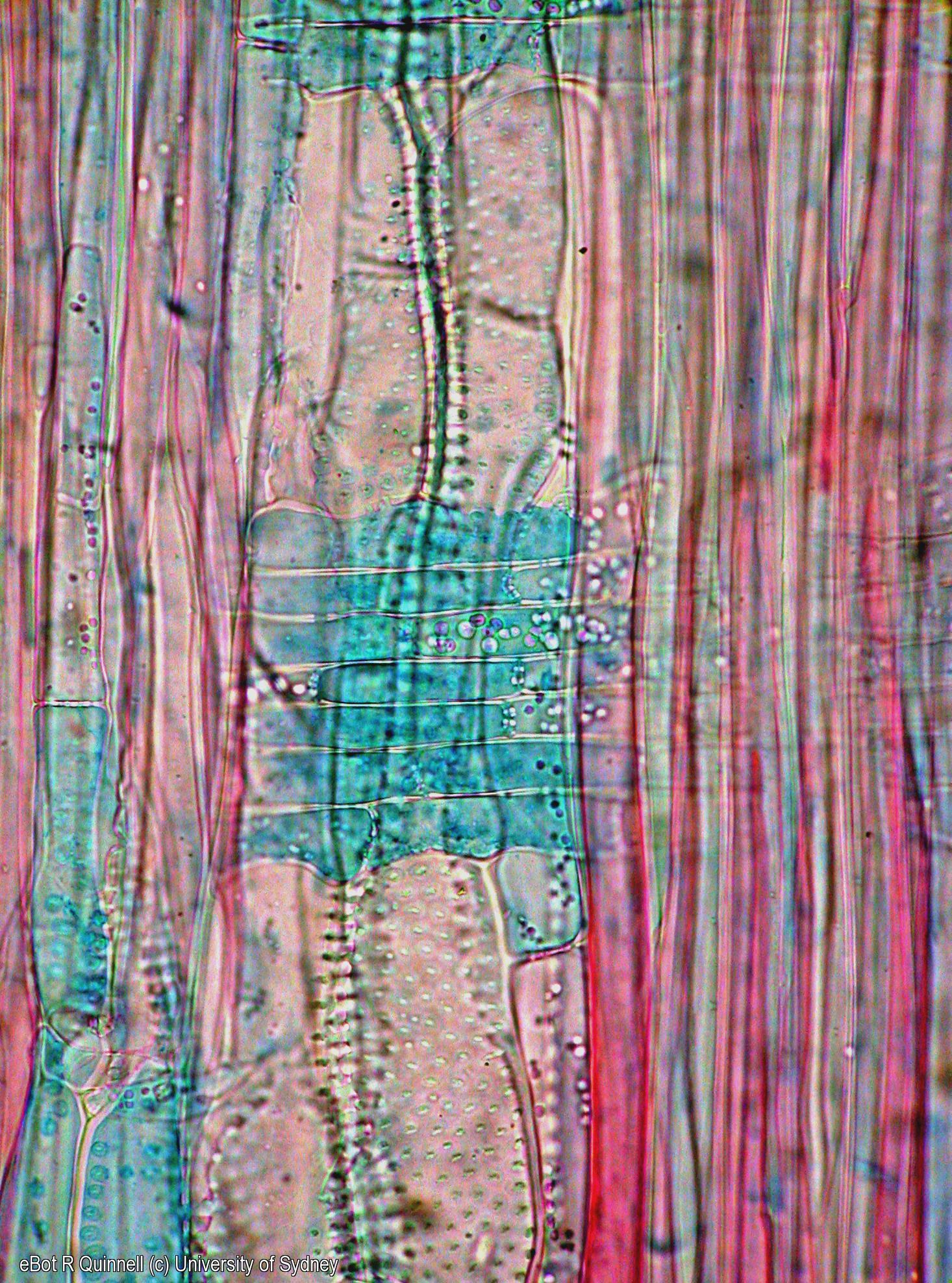 RLS Acacia longifolia woody stem