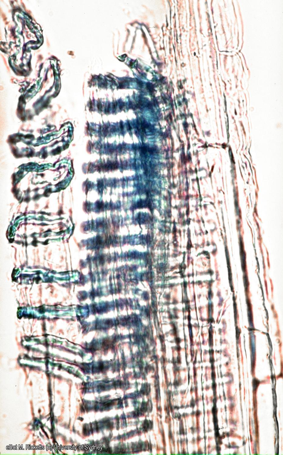 Cell macerate of Cucurbita stem xylem