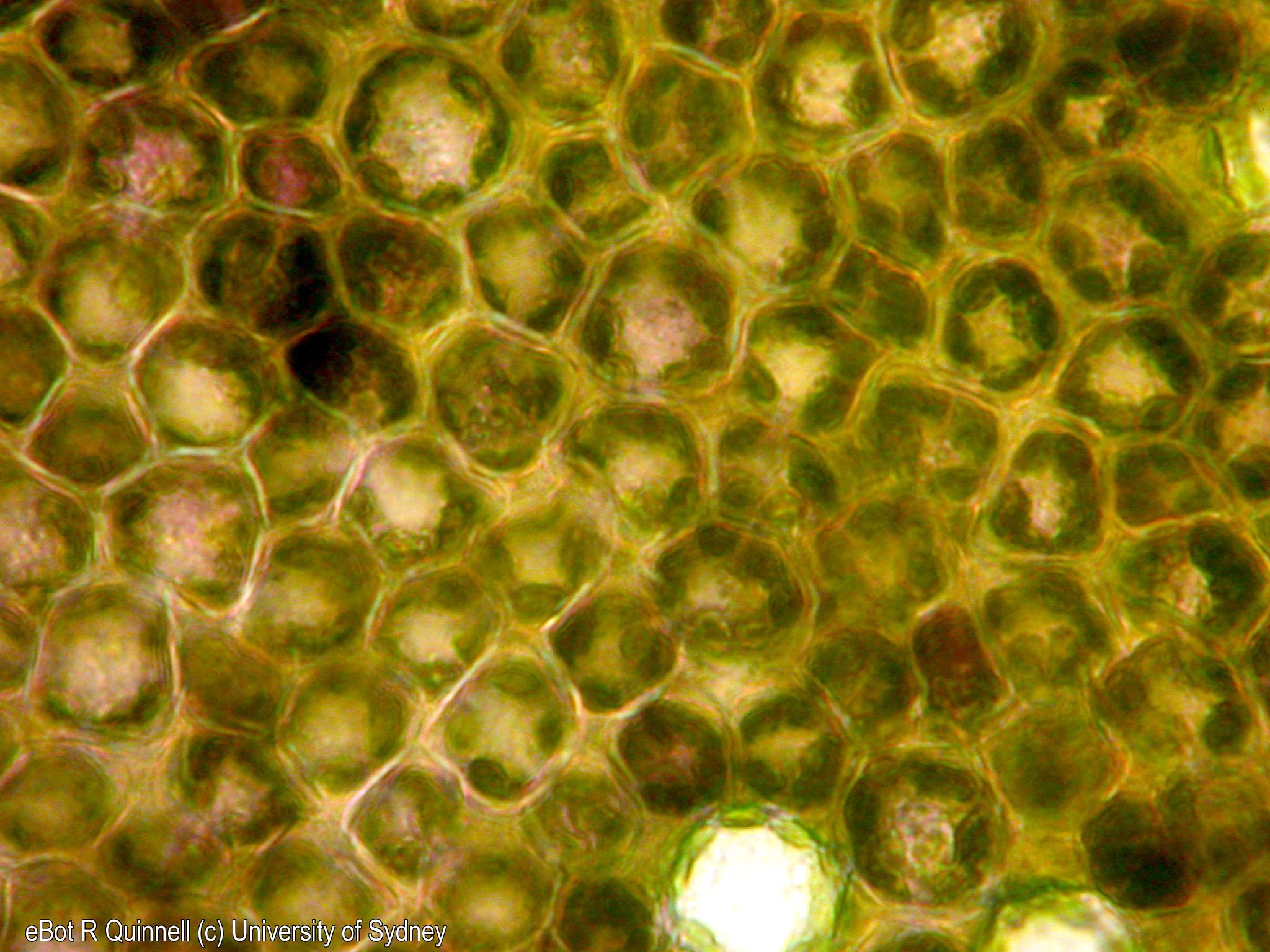 Paradermal section Ligustrum leaf