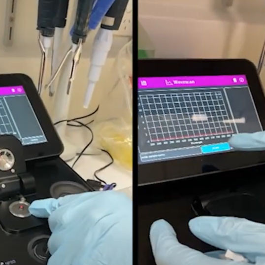 Personalising TB Treatment with Pain-Free Drug Monitoring