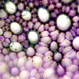 TS Apium graveolens (celery) primary xylem