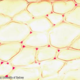 Development of sclerenchyma: secondary thickening